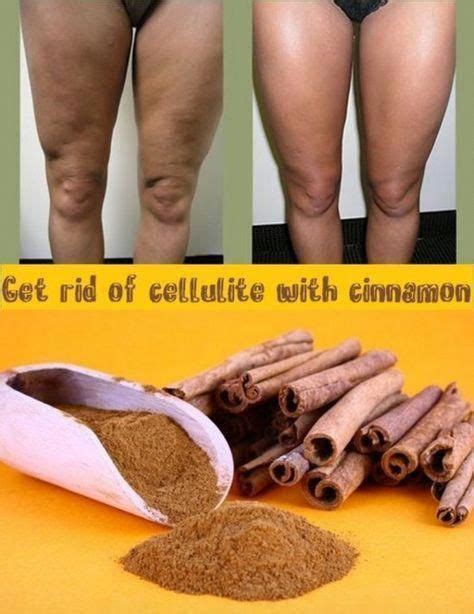Pin On Cellulite Removal Tips