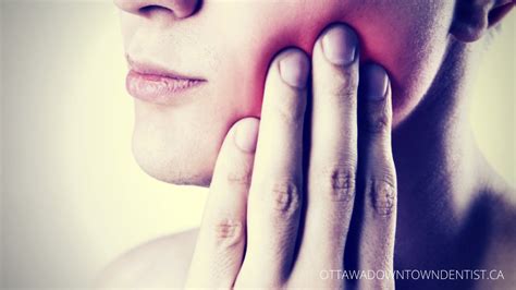 Some Common Causes Of Toothache Professional Ottawa Downtown Dentist