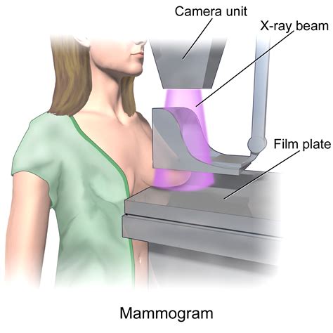 Mammography Undergraduate Diagnostic Imaging Fundamentals