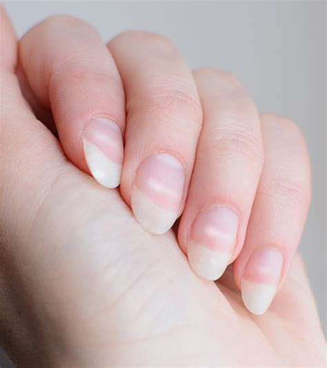While harmless, these white spots indicate that you need to eat a healthy, balanced diet. White Spots On Fingernails Causes And Treatment
