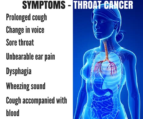 Throat Cancer Symptoms Pictures Causes And Treatment Hot Sex Picture