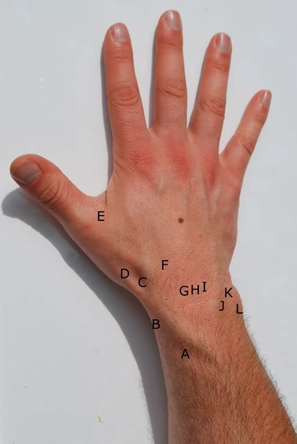 Wrist Pain Differential Diagnoses - WikiMSK