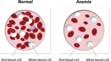 What Medications Cause Enlarged Red Blood Cells