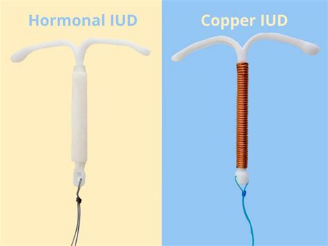 What type of iud's are available? Meet the IUD: Introduction into IntraUterine Device | ASPIVIX