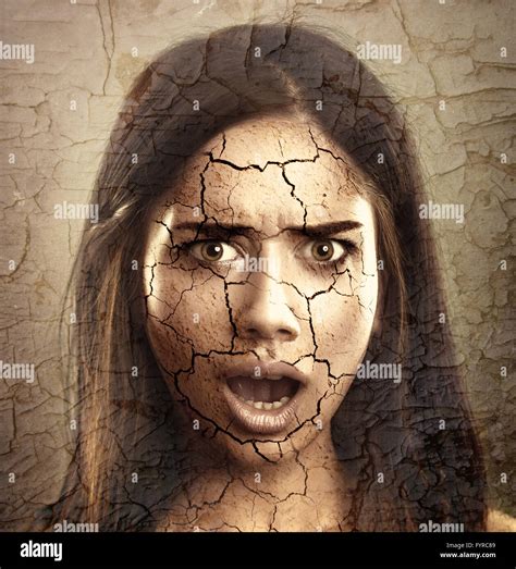 Dry Cracked Skin Hi Res Stock Photography And Images Alamy