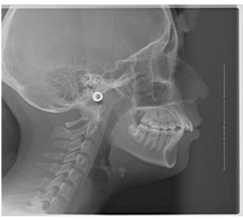 Radiografía Cefálica Lateral Download Scientific Diagram