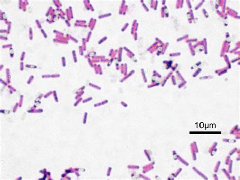 Bacillus Wikipedia
