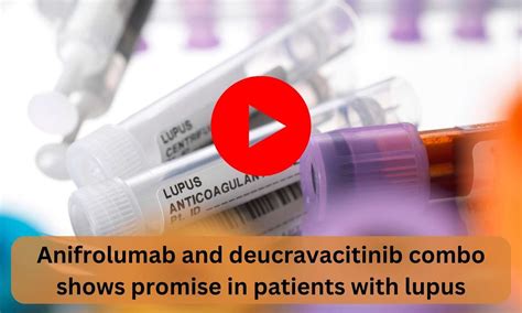 Anifrolumab And Deucravacitinib Combo Shows Promise In Patients With Lupus