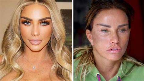 Katie Price Quits Social Media After Cruel Trolls Accuse Her Of Making Up ‘assault And Says