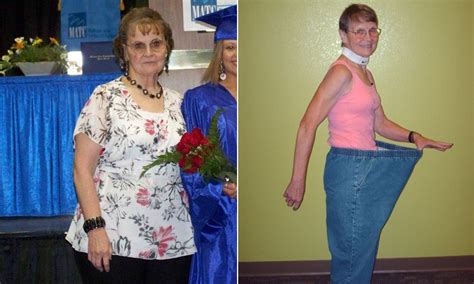 betty lou age 72 lost 115lb and set record for longest abdominal plank wow before and after