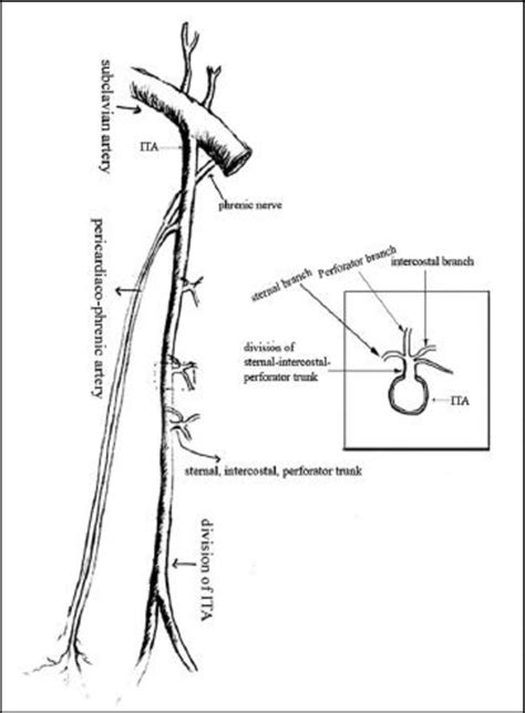 Diagram Of Internal Thoracic Artery Ita Its Branches And Sites For