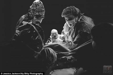 Photographer Jessica Jackson Wants To Rid C Section Stigma Daily Mail Online