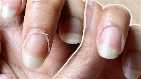 Nail Transformation How I Cut Cuticles At Home Basic Tools Only