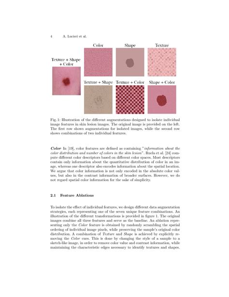 Revisiting The Shape Bias Of Deep Learning For Dermoscopic Skin Lesion