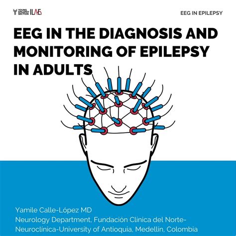 Infographics International League Against Epilepsy
