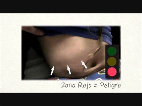 Red Zone Abdominal Retractions
