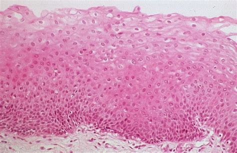 Stratified Squamous Epithelia Diagram Quizlet