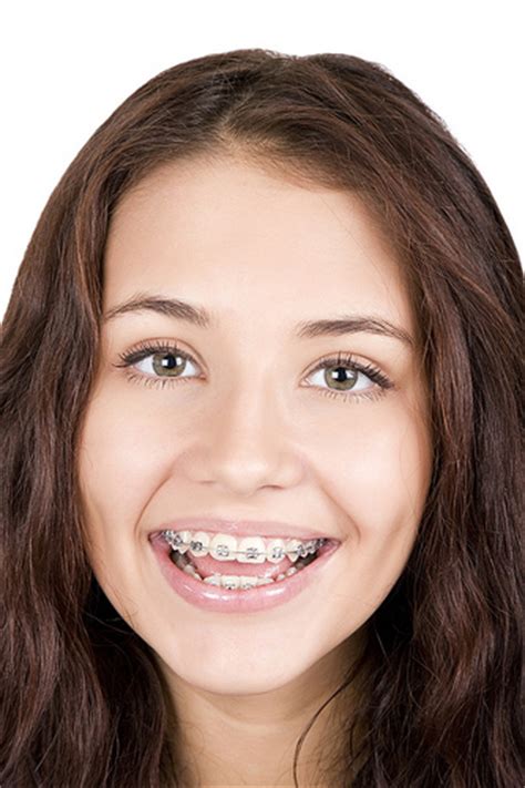 Misconceptions About Orthodontics Clear Advantage Orthodontics