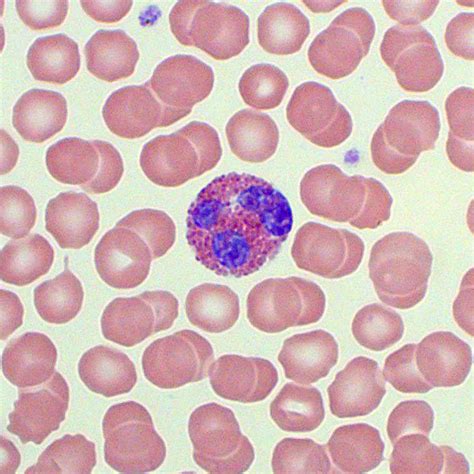 Eosinophil Image The Image Of Collection