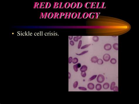 Ppt Red Blood Cell Morphology Powerpoint Presentation Free Download