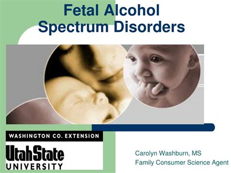 Ppt Fetal Alcohol Spectrum Disorders Powerpoint Presentation Free