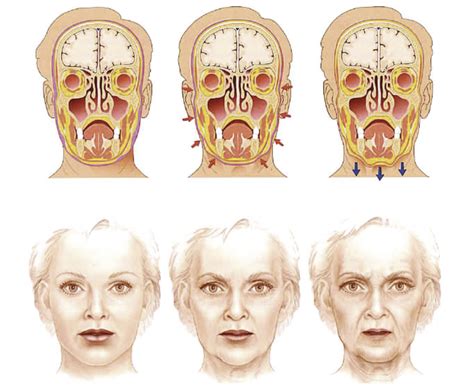 Aging And Anatomy In Retouching Mk Retouching
