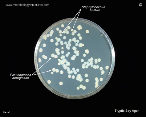 Agar Plate With Tryptic Soy Agar And Isolated Colonies Of Pseudomonas