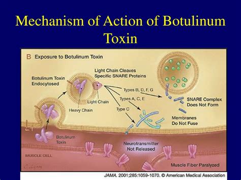 Ppt Taking The Wrinkles Out Of The Bladder The Use Of Botulinum Toxin