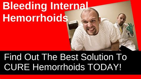 I only had one shot of depo provera and bled most of the time on that so didn't go for my second shot beginning of november. Bleeding Internal Hemorrhoids - How To Stop It! - YouTube