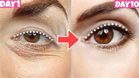 Eye Lift Exercise Get Bigger Eyes Prevent Droopy Eyelids Sagging Eyelids Massage You Must Do