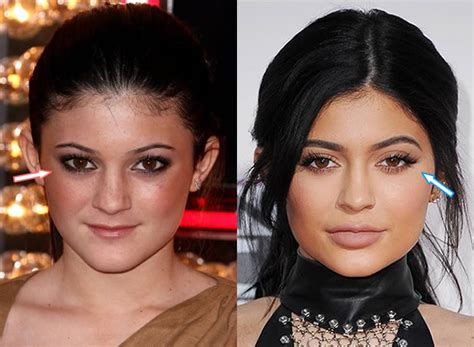 Know CemSim: Kylie Jenner Body Before Plastic Surgery