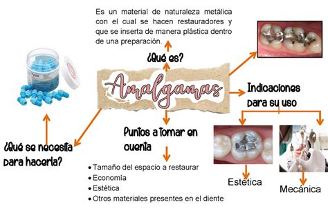 Amalgamas La Amalgama Dental Es Un Material Común Que Se Usa Para