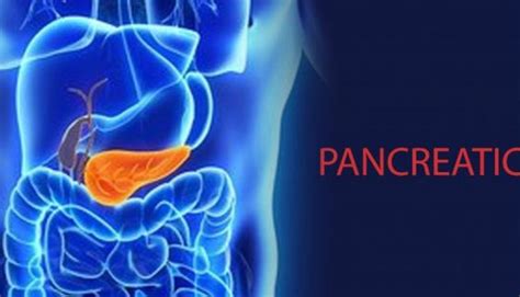 Pancreatic Cancer Archives Positive Bioscience