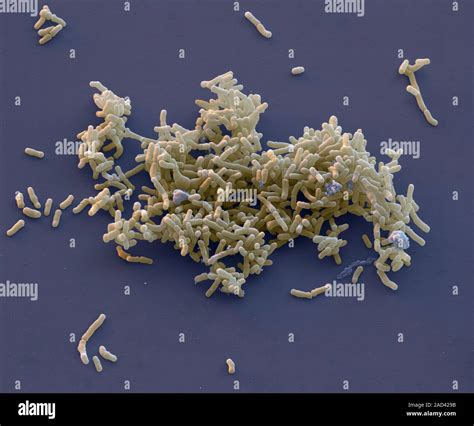 Bifidobacterium Bacteria Coloured Scanning Electron Micrograph Sem