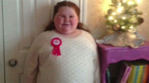 obese girl denied weight loss surgery for rare illness latest news videos fox news