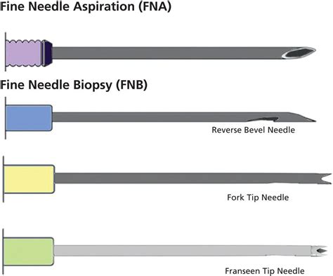 How To Perform Pancreatic Mass Fine Needle Biopsy Radiology Key