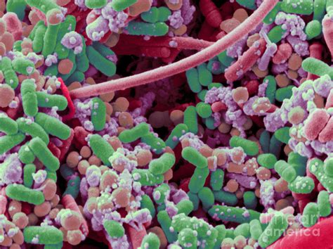 Bacteria In Human Tonsil Pus Sem Photograph By Scimat