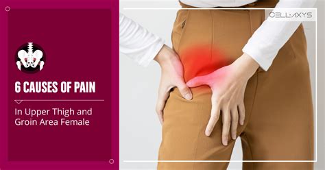 6 Causes Of Pain In Upper Thigh And Groin Area Female Cellaxys