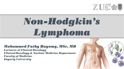 Non Hodgkins Lymphoma Youtube