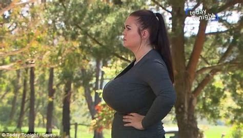 Woman With 34k Boobs That Won T Stop Growing Asks Strangers To Pay For Reduction Surgery