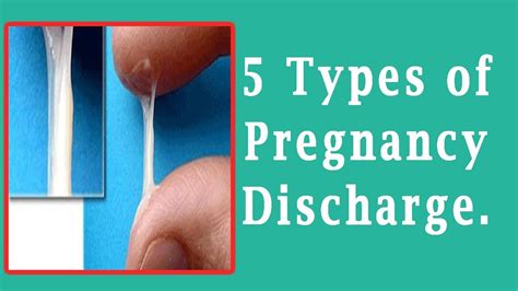 Discharge During Pregnancy 5 Types Of Pregnancy Discharge Youtube