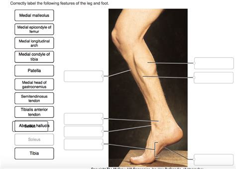 Correctly Label The Muscles Of The Thigh Medial C Che