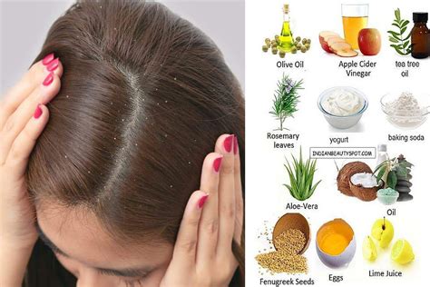 Feeling Embarrassed Because Of Dandruff Check Out These Remedies The
