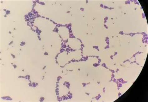 Gram Positive Cocci Arranged In Clusters Seen On Grams Staining