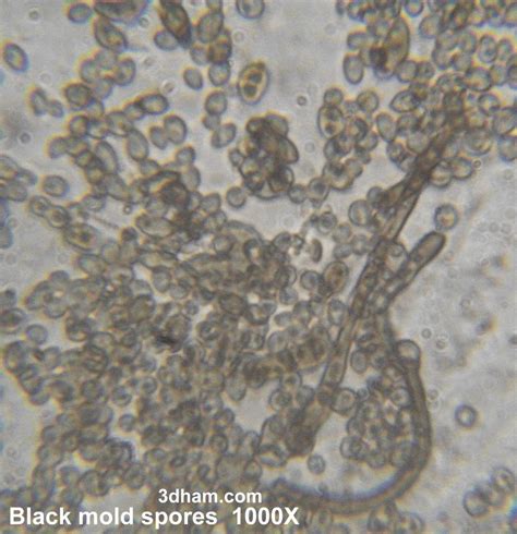 As a newbie to microscopes, i have been trying to look at hair under a compound microscope. Black mold spores (from an orange)