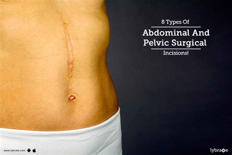 Types Of Abdominal And Pelvic Surgical Incisions By Dr Ajay Gupta