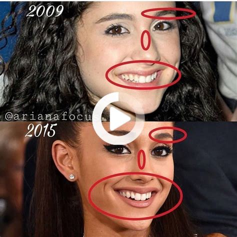 BEFORE AND AFTER in 2020 | Celebrity plastic surgery, Plastic surgery, Bad celebrity plastic surgery