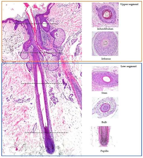 Histology Of Hair Follicle Vertical And Horizontal Sections