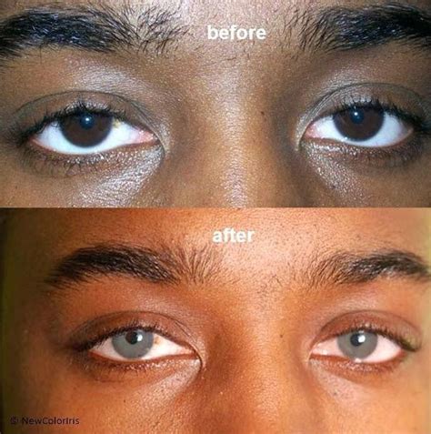 Our subliminals work and we have the science to back it. Is there any way to get lighter eyes and do subliminals ...