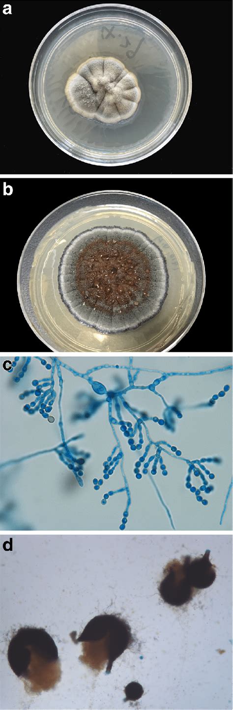 Mycological Findings Ab Fungal Culture Incubated At 26 °c On